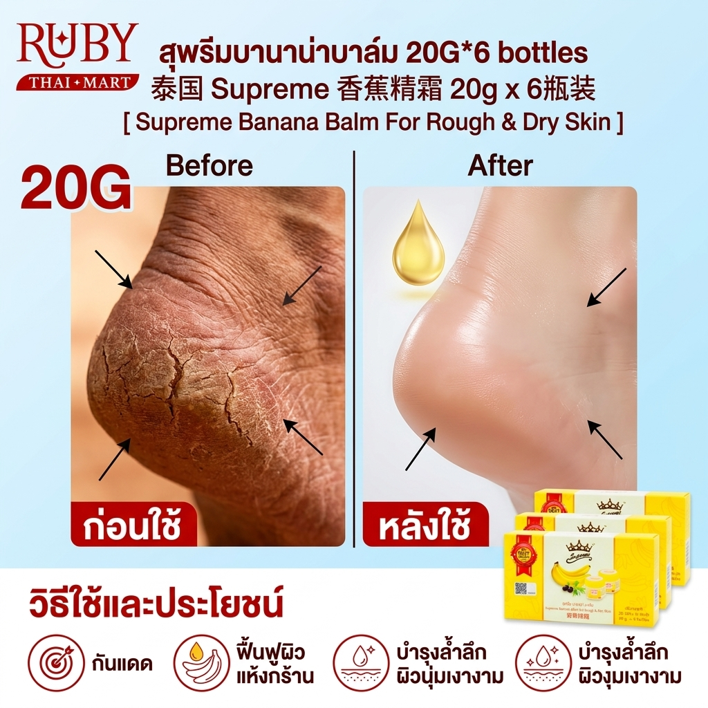🔥 สุพรีม บานาน่า บาล์ม (Supreme Banana Balm For Rough & Dry Skin) แพ็ค 6 กระปุก สินค้าขายดี! 🔥